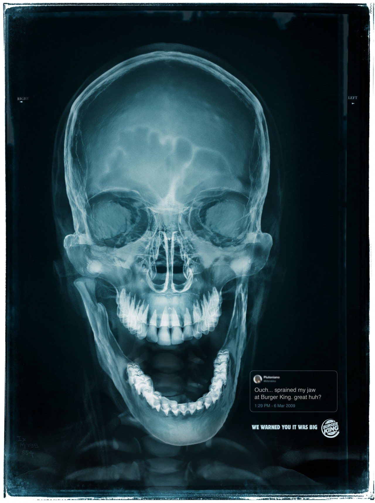 汉堡王:吃到下巴都脱臼的汉堡