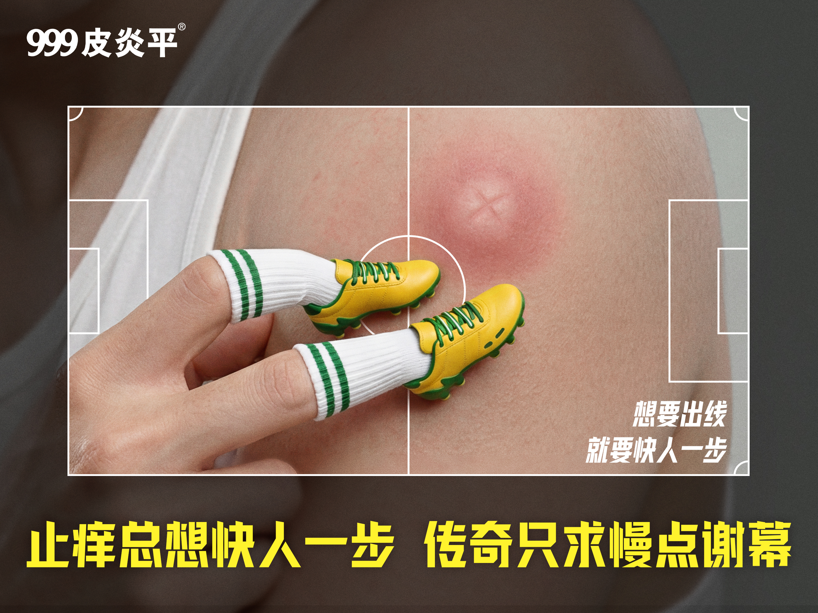 999皮炎平世界杯：止痒想要快人一步，传奇只求慢点谢幕