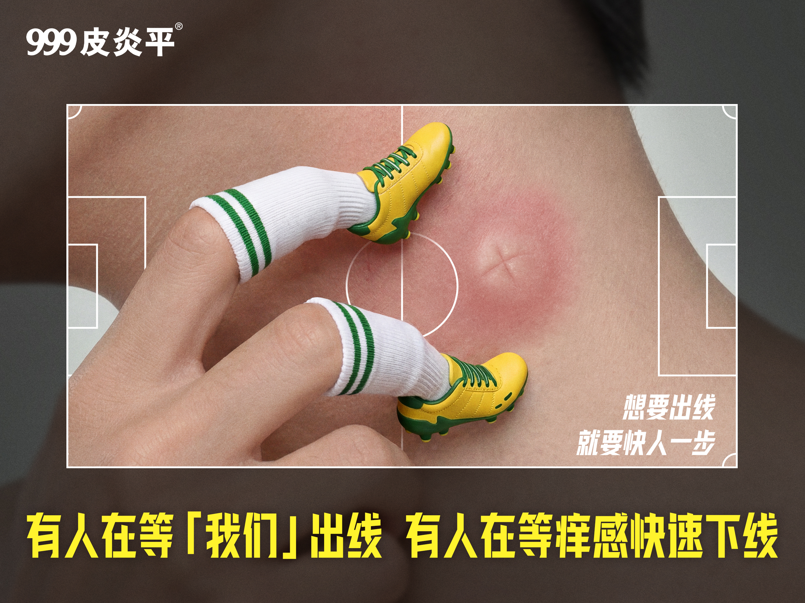 999皮炎平世界杯：止痒想要快人一步，传奇只求慢点谢幕